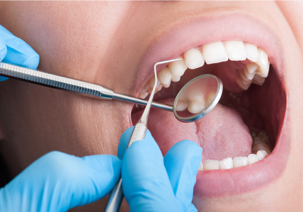 Teeth Cleaning St. Louis | Family Dentistry | Restorative Dentistry Services Near Me